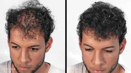 Miniatura 2 de Fibras capilares voluminizadoras con queratina real para adelgazar el cabello/pérdida de cabello – Dermatológicamente probado y certificado