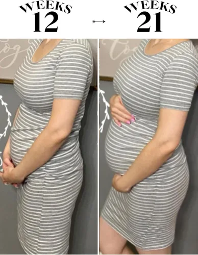 Miniatura 4 de Liu & Qu - Vestido de maternidad para mujer, de manga corta o manga 34, fruncido, para uso diario o baby shower