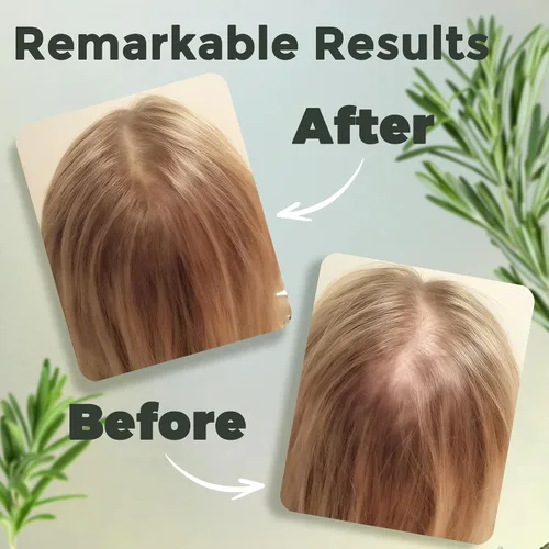 Miniatura 5 de YBW Aceite de romero para el crecimiento del cabello, aceite orgánico para el cabello de romero con biotina, ricino y jojoba, fortalece, nutre