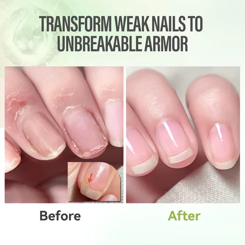 Miniatura 4 de CHUCHU Fortalecedor de aceite para cutículas de uñas, tratamiento hidratante de reparación de aroma de aloe vera, jojoba natural vitamina B y E