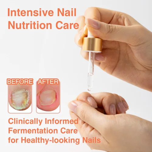 Miniatura 2 de TuneTune - Aceite para cutículas de 0.3 fl oz Aceite de uñas coreano fermentado para uñas y cutículas Aceite hidratante para cutículas secas