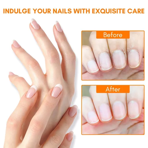 Miniatura 4 de Makartt Lápiz de aceite para cutículas, cuidado de uñas: 12 piezas de reparación y suavizante con vitamina E, kit de crema hidratante para uñas