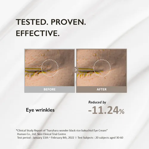 Miniatura 7 de Crema de ojos de arroz negro Bakuchiol Haruharu Wonder 0.67 fl.oz / 20ml Antienvejecimiento, cuidado de arrugas, alternativa natural al retinol
