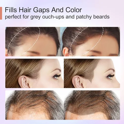 Miniatura 7 de Acomler Color de Cabello en Polvo de Sombra para Retoque Instantáneo de Raíces, Cobertura de Raíces, Marrón Oscuro para Cabello Ralo, Cobertura