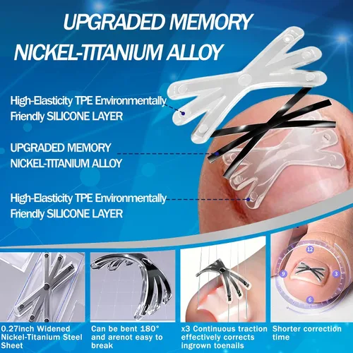 Miniatura 2 de Tratamiento de uñas encarnadas con forma mejorada de 6 ángulos, corrector de uñas encarnadas de aleación de titanio para un alivio rápido, kit