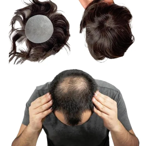 Voloria Parche para el cabello calvo para hombres, 3.15 x 3.15 pulgadas, sistema de reemplazo de cobertura completa de piel de poliuretano (#2 color