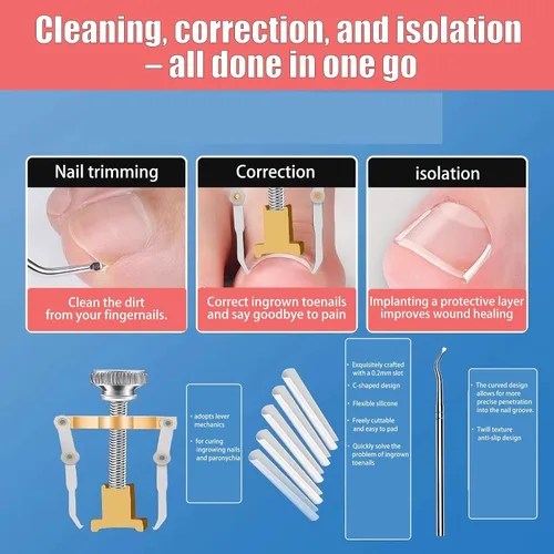 Miniatura 4 de Corrector profesional de uñas encarnadas para un alivio rápido con tiras transpirables de uñas encarnadas, herramientas de pedicura de acero