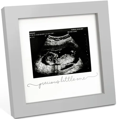 KeaBabies Portarretratos de ecografía para bebé, modernos marcos de fotos de ultrasonido para mamá, regalos de primer embarazo para futura mamá y