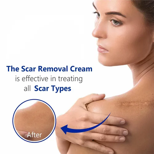 Miniatura 6 de Gel avanzado para cicatrices quirúrgicas, cara, cuerpo, piernas, quemaduras, acné, cesárea, estrías, queloides, eliminación eficaz de cicatrices