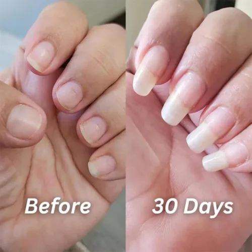 Miniatura 4 de Nailz Aplicador de bolígrafo para uñas y cutículas, aceite radiante para cutículas para fuerza y humedad, suero de rejuvenecimiento para cutículas