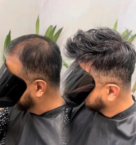Miniatura 24 de SIMBEAUTY Cabello humano súper natural para hombre, estilo libre de tupé, 10 x 8 pulgadas, sistemas de reemplazo de cabello para hombres