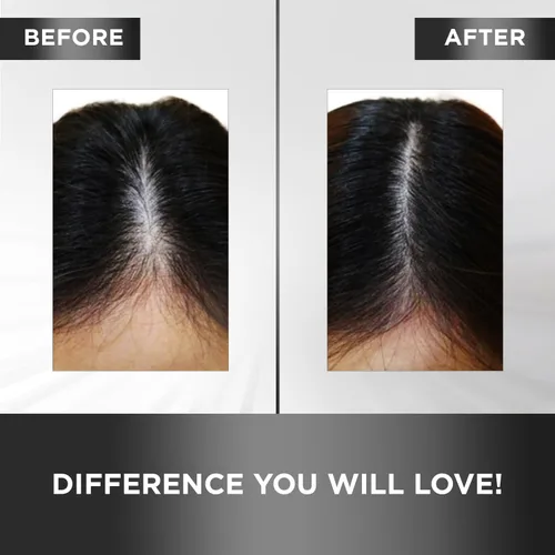 Miniatura 4 de MOEHAIR Tónico capilar Mejora la salud del cuero cabelludo y el cabello Estimula los folículos Tónico voluminizador Infundido con aceite