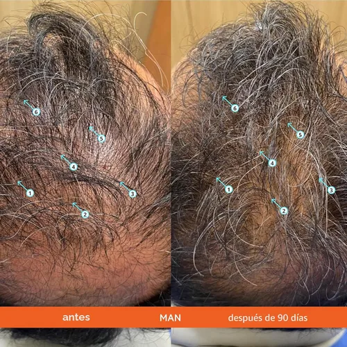 Miniatura 4 de DS Labs - Kit de champú y acondicionador Revita para hombres y mujeres, sistema de cuidado del cuero cabelludo de dos pasos para cabello