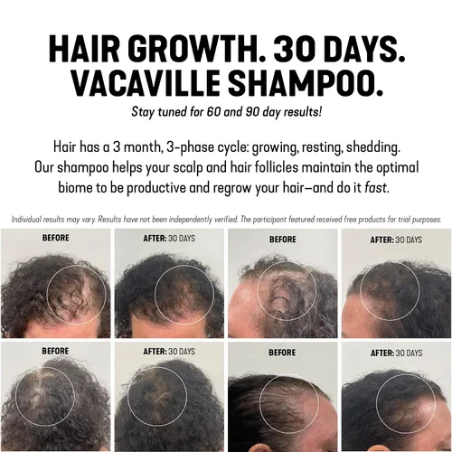 Miniatura 8 de Vacaville Beauty Powder Shampoo for Hair Growth, Orange Scented Waterless, Eco Friendly & Travel Shampoo Natural Vegan Formula for Thinning Hair