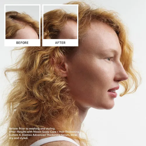 Miniatura 2 de Nioxin System 4 - Acondicionador para cabello teñido, seco y dañado con adelgazamiento progresado, mantiene un color vibrante, nutre y aumenta