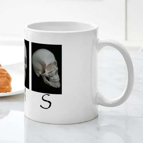 Miniatura 5 de CafePress OMS - Taza quirúrgica con diseño de calavera de 11 oz (11.0 fl oz)