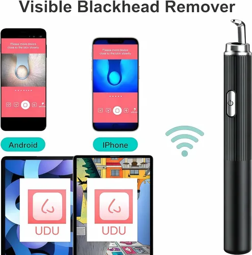 Miniatura 4 de Removedor de puntos negros con cámara, herramientas de eliminación de puntos negros visuales WiFi con luces blancas/azules para iPhone, teléfonos