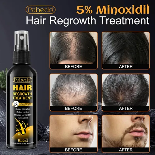 Miniatura 6 de NATURE ZIRAN Suero para el crecimiento del cabello, 5% de minoxidil para hombres y mujeres, espuma sin perfume para el crecimiento del cabello