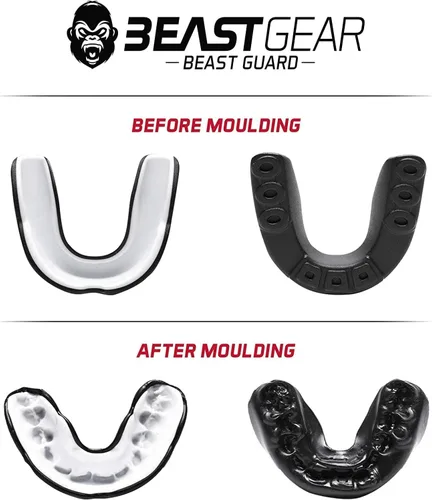 Miniatura 7 de Beast Gear Protector bucal deportivo, protector bucal para adultos y jóvenes, para boxeo, fútbol, lacrosse, baloncesto, rugby, artes marciales