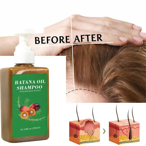 Miniatura 2 de Champú de aceite de Batana,Aceite de batana para el crecimiento del cabello,Champú DeBatana Para La Caida Del Cabello,Champús contra la pérdida
