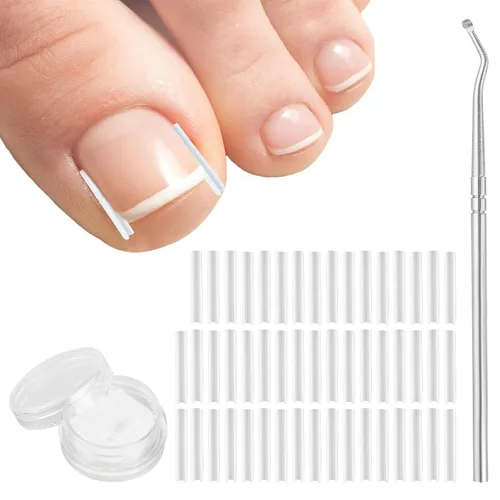 (50+1) Juego de tratamiento corrector de uñas encarnadas, kit profesional de eliminación de uñas encarnadas sin dolor con levantador de uñas de los