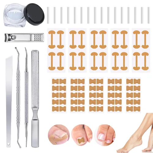 Juego profesional de uñas encarnadas con tiras transpirables de uñas encarnadas, tiras correctoras de uñas de los pies, parche corrector de uñas