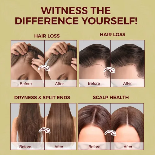 Miniatura 3 de Lupure Aceite de batana para el crecimiento del cabello: Aceite de batana 100% crudo puro orgánico y natural para el crecimiento del cabello