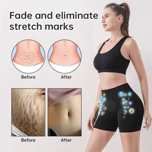 Miniatura 3 de Mixdameny Shapermov - Pantalones cortos moldeadores de iones, tela transpirable y cómoda, pantalones cortos con levantamiento de glúteos para mujer