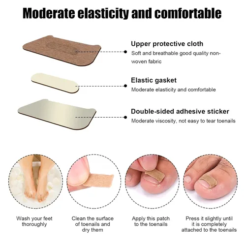 Miniatura 3 de Corrector de uñas encarnadas, 100 parches correctores transpirables con nudo de lazo y 120 tiras de uñas encarnadas ranuradas, herramienta de cinta