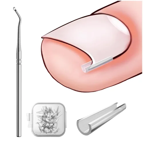 BEZOX Juego de Corrector de Uñas Encarnadas - 40 Piezas de Tiras Enderezadoras de Uñas sin Dolor con Elevador de Uñas del Pie - Kit de Herramientas