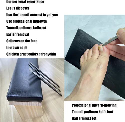 Miniatura 3 de Cuchillo de pedicura, herramientas para uñas encarnadas, reposabrazos inclinado para uñas, utilizado para removedor de cutículas de uñas, callo
