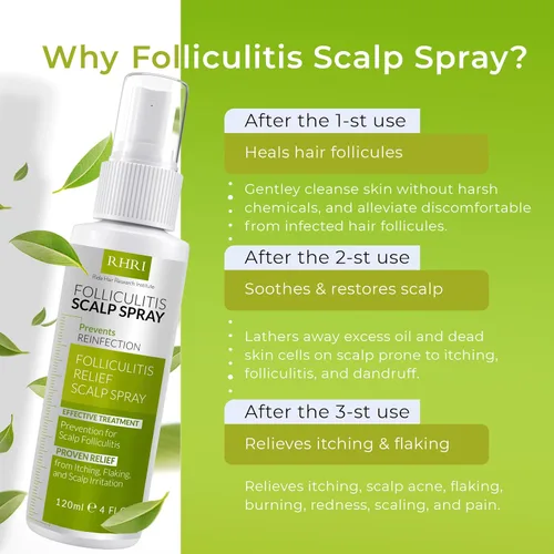 Miniatura 4 de Spray para el cuero cabelludo para foliculitis Tratamiento de la caspa para la psoriasis y la foliculitis Fórmula de tratamiento antifúngico