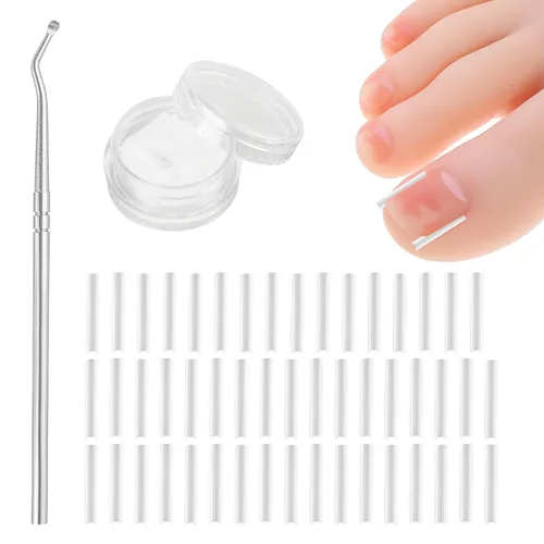 (50+1) Juego de corrector de uñas encarnadas, kit profesional de eliminación de uñas encarnadas sin dolor con levantador de uñas de los pies, tira