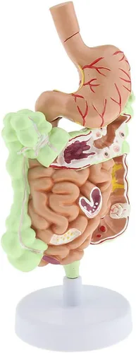 Miniatura 2 de KESOTO Modelo de Patología Gastrointestinal Humana Modelo Coronal Gástrico del Tracto Digestivo para Estudiantes Escolares Aprendizaje