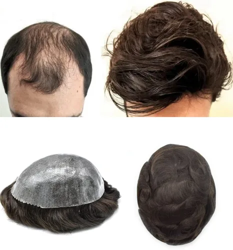 Miniatura 30 de Toupee - Sistema de reemplazo de cabello humano para hombre, 0.004 in, inyectado, piel de polietileno, piezas de pelo para hombre, 6 x 8 pulgadas