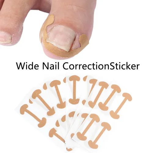 Miniatura 4 de Juego de corrector de uñas encarnadas con tiras de corrección,Kit de herramientas profesional de uñas encarnadas,Parche corrector de uñas
