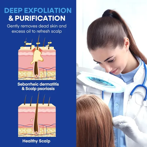 Miniatura 5 de Champú medicado para la dermatitis seborreica del cuero cabelludo y la psoriasis: Fórmula a base de plantas alivia la picazón, reduce las escamas