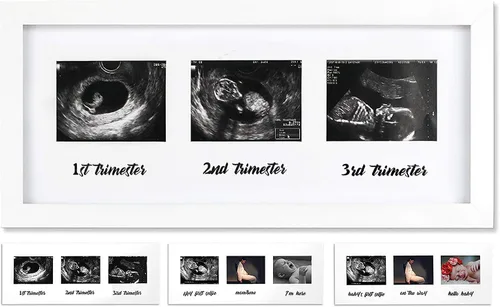 Miniatura 9 de IHEIPYE Marco de Embarazo de Triple Sonograma – Marco de Fotos de Ultrasonido de Bebé con Historia para Futuros Padres, Marco de Baby Shower, Marco