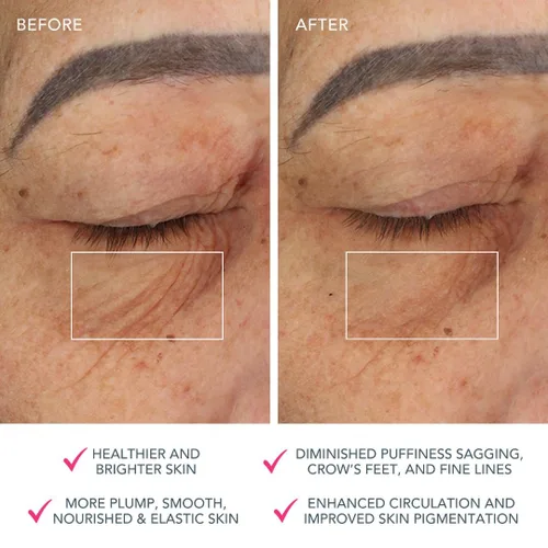 Miniatura 5 de FOREO Bear Dispositivo Facial de Microcorriente - Herramienta de Esculpido Facial - Lifting Facial Instantáneo - Reafirma y Contornea - No Invasivo