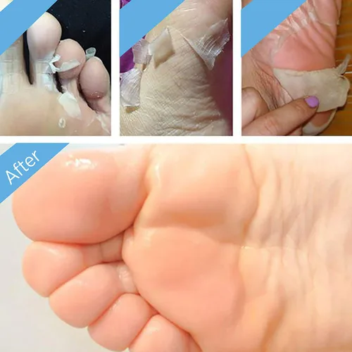 Miniatura 5 de Bea Luz - Mascarilla exfoliante para pies suaves (2 pares, 1 a 2 semanas), para pelar callos y piel muerta, para hombres y mujeres