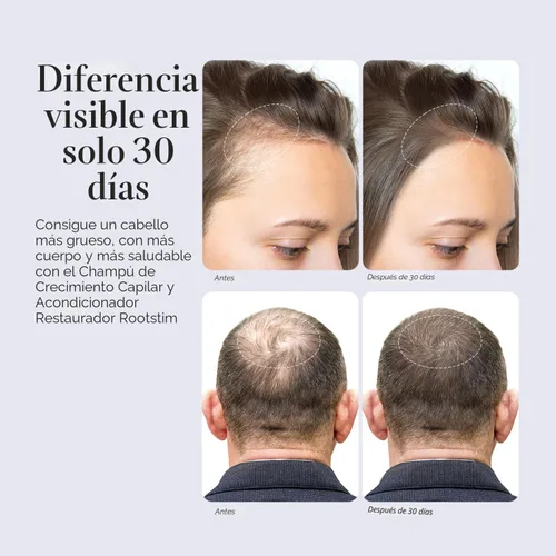 Miniatura 4 de Set de champú y acondicionador para el crecimiento del cabello, champú y acondicionador de romero y biotina para engrosar el cabello, impulso