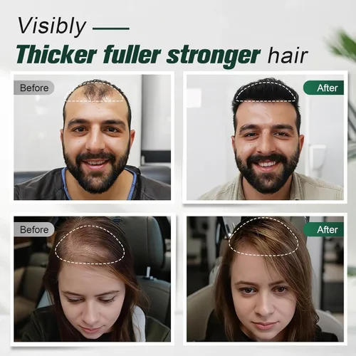 Miniatura 4 de Champú voluminizador de cabello y queratina para cabello más grueso y saludable, champú voluminizador