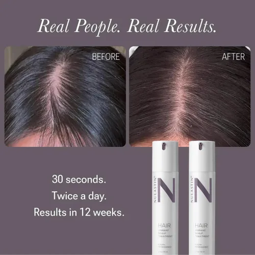 Miniatura 3 de NULASTIN Suero para cuero cabelludo, tratamiento vibrante para ayudar a mejorar el aspecto de la densidad del cabello, fórmula ligera y de rápida