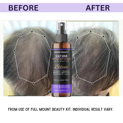 Miniatura 5 de Believe Scalp Spray Natural DHT Blocker & Combate la Caída del Cabello Con extractos de romero, palma enana americana, amla, methi y bhringraj