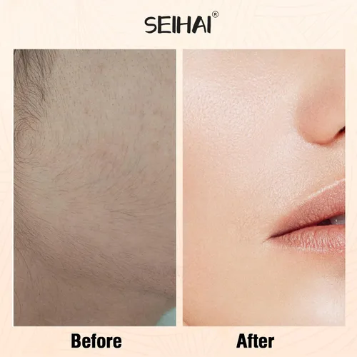 Miniatura 4 de Depilación facial para mujeres, removedor de vello facial eléctrico sin dolor recargable para cara, labios, barbilla con 2 cabezales de repuesto