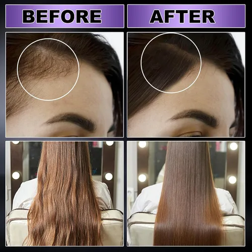 Miniatura 4 de GIFBEA Spray orgánico de suero para el crecimiento del cabello con agua de arroz negro, 5 onzas líquidas, aroma de romero, para todo