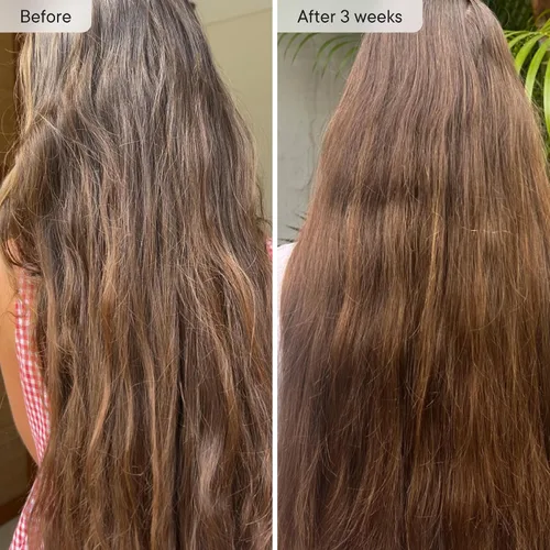 Miniatura 2 de Qure Cabezal de filtro de ducha para agua dura, cabello, piel y uñas más saludables, reduce el 99% de cloro, cabezal de ducha de alta presión