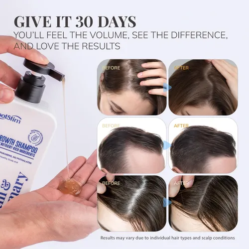 Miniatura 5 de Champú de biotina y romero para el crecimiento del cabello: Champú para la pérdida de cabello para cabello fino infundido con ingredientes ricos