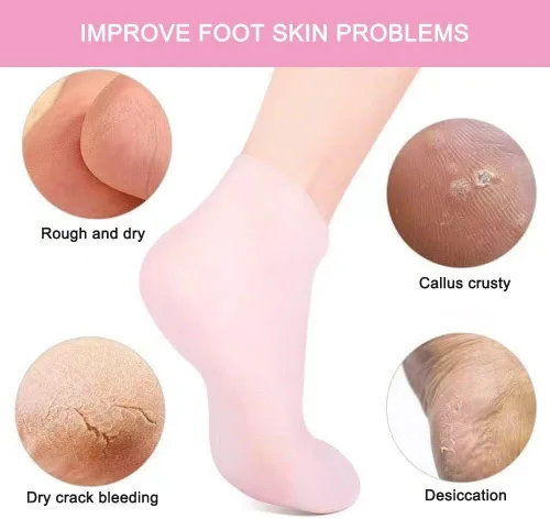 Miniatura 4 de 2 pares de calcetines hidratantes suaves de silicona, calcetines hidratantes para piel seca y dura agrietada, calcetines de gel de spa hidratantes
