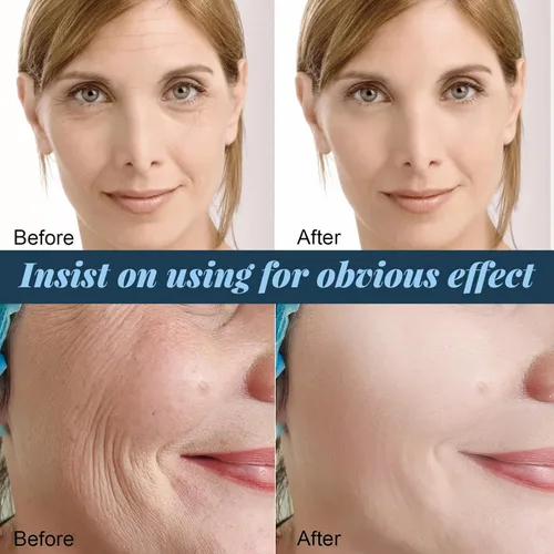 Miniatura 7 de Hilos de proteína soluble coreana, hilos de proteína para el cuidado facial en el hogar, hilo de colágeno soluble para rutina de cuidado de la piel